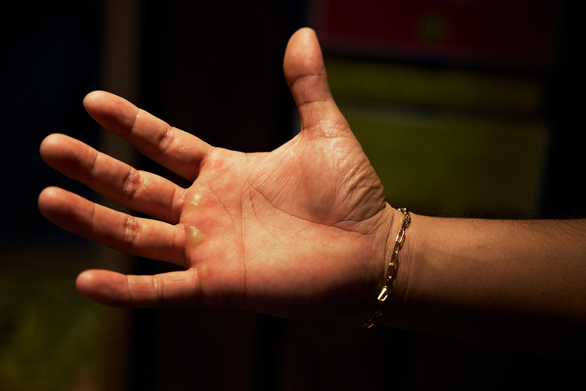 プロレスラー辻陽太さんの手のひら